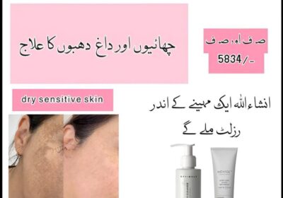 WhatsApp-Image-2025-07-28-at-11.40.21-AM