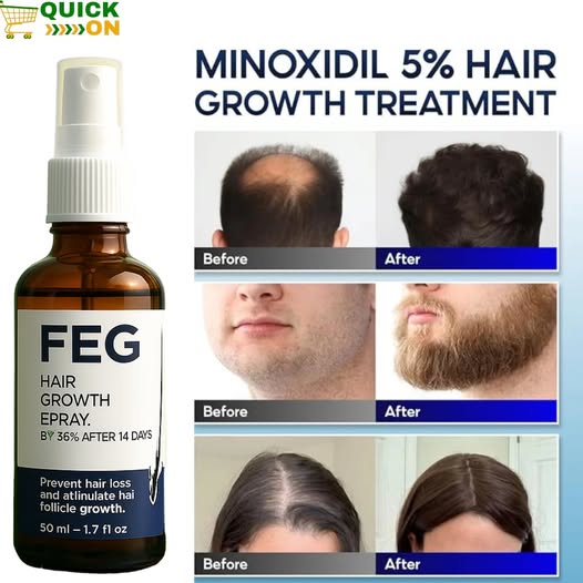 FEG Plus Hair Growth Spray in islamabad – 100% Herbal Solution for Stronger Hair – 03001819306