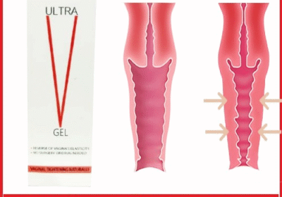 Ultra V Gel 1731604362