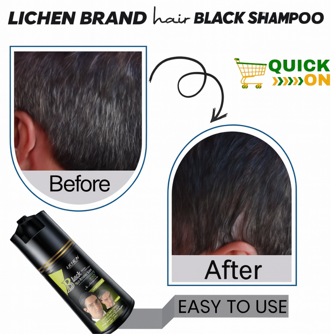 FEG Plus Hair Growth Spray price in Shahdadkot 03001819306
