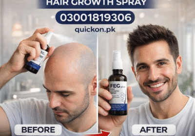 FEG Plus Hair Growth Spray feg-plus-hair-growth-spray-1-8