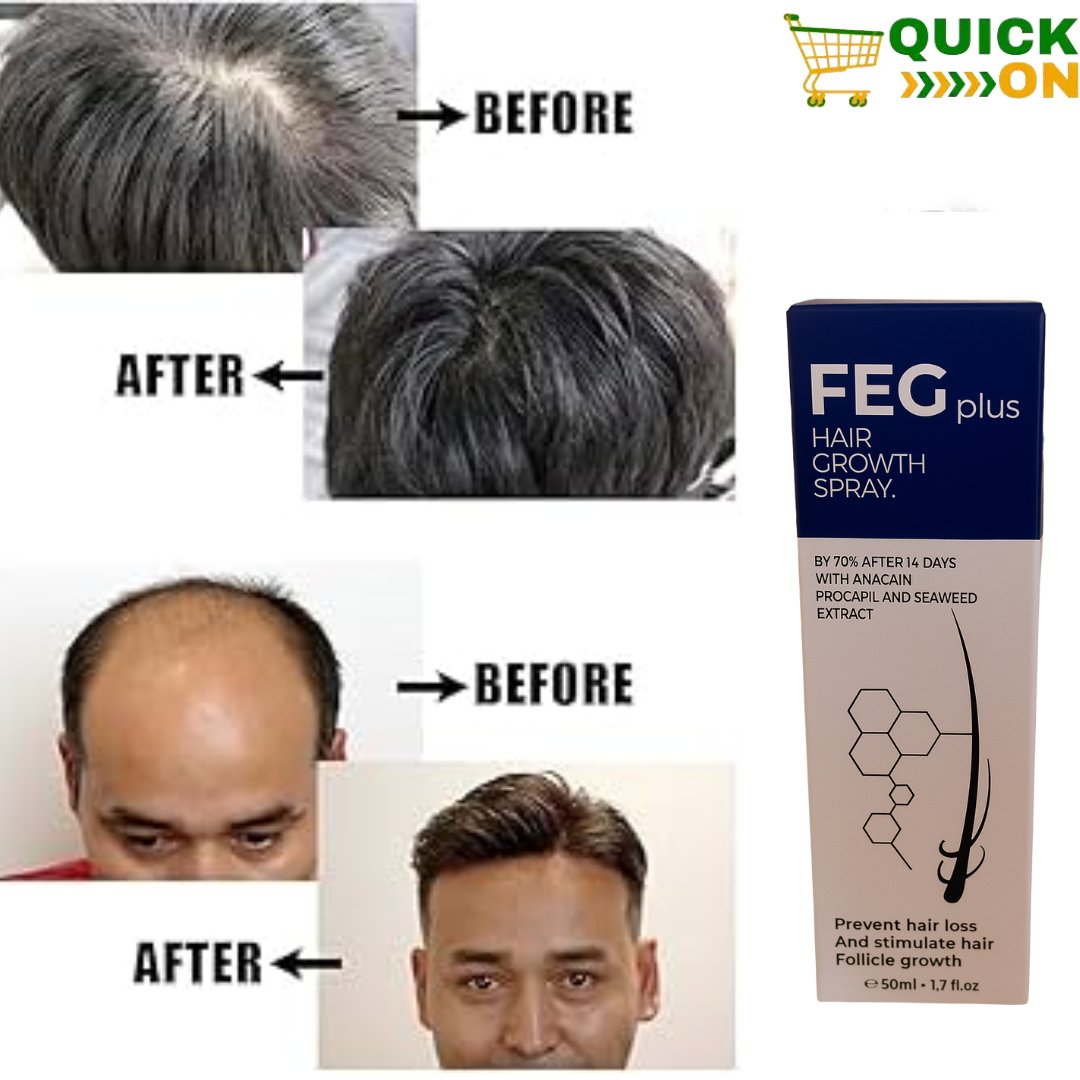 FEG Plus Hair Growth Spray Price in Chiniot: 03001819306