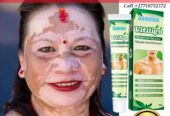 Get Rid Of Vitiligo In Vieille Case Village in Dominica Island, Dominica And Vaasa City In Finland Call +27710732372 Scars And Stretch Marks In Byron Township in Minnesota, United States And Vereeniging City In South Africa