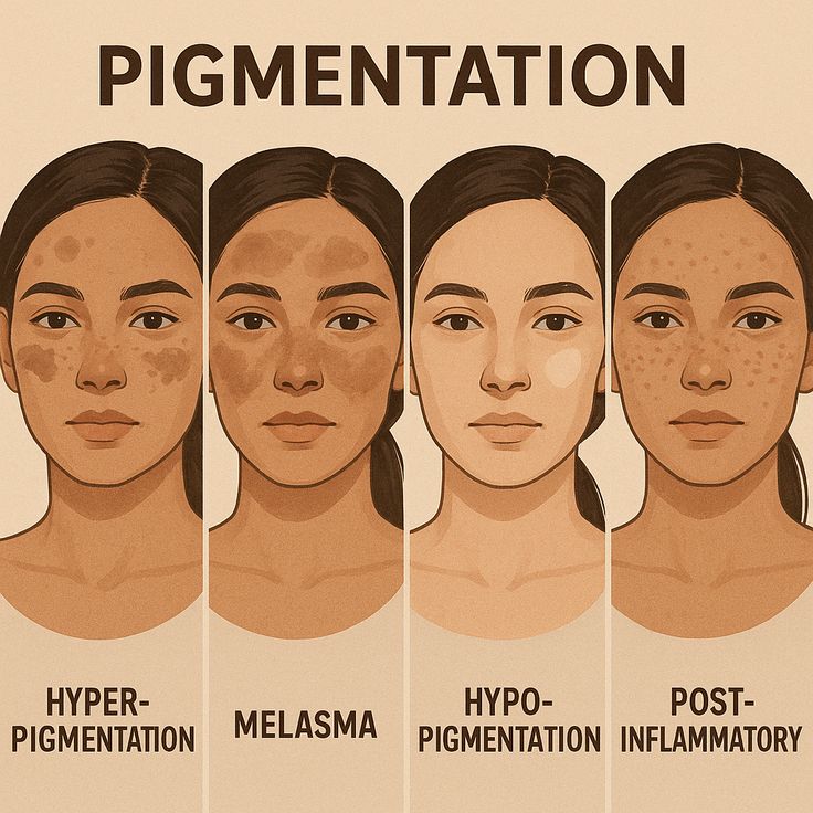 Today topic pigmentation